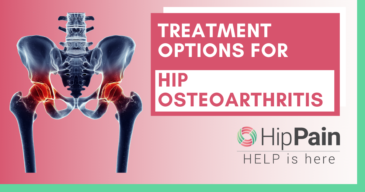 Treatment options for hip osteoarthritis