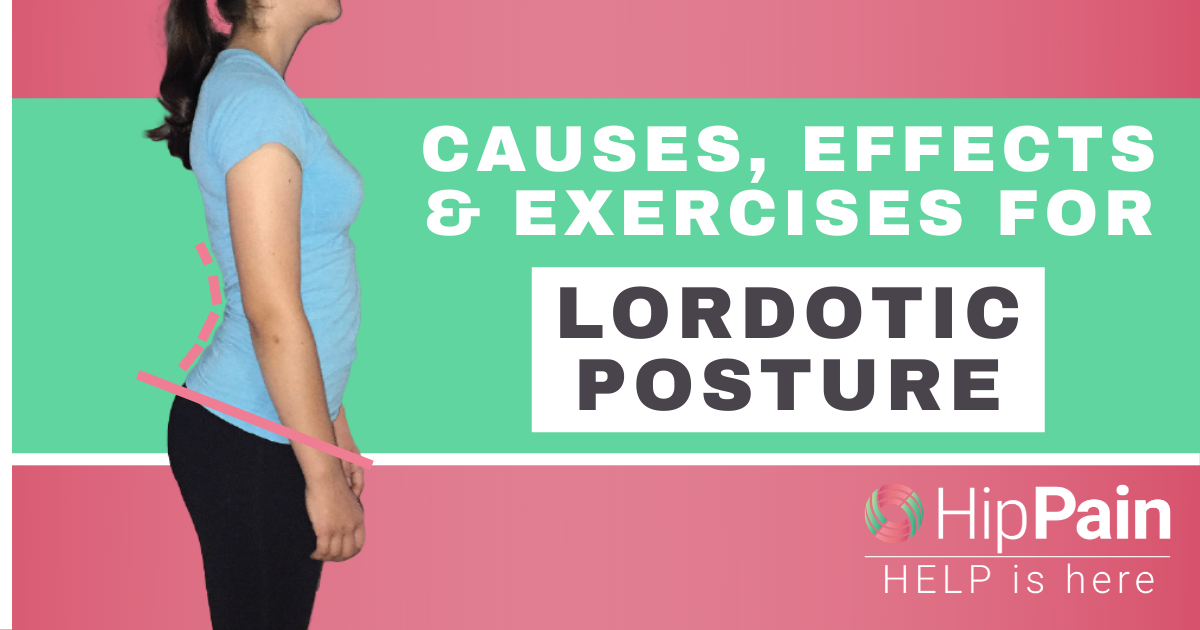 lordotic posture: what why and exercise for lordosis