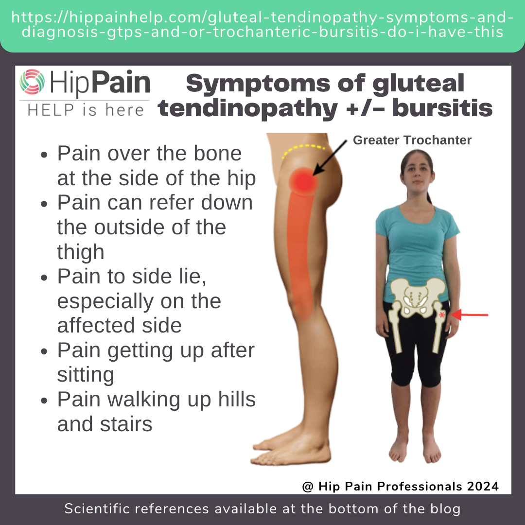 Do I have Gluteal Tendinopathy or Hip Bursitis? Symptoms & Diagnosis