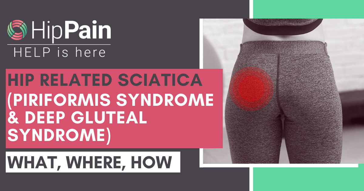 Hip Related Sciatica (Piriformis Syndrome & Deep Gluteal Syndrome)