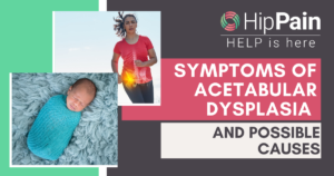 symptoms of acetabular dysplasia and causes of acetabular dysplasia
