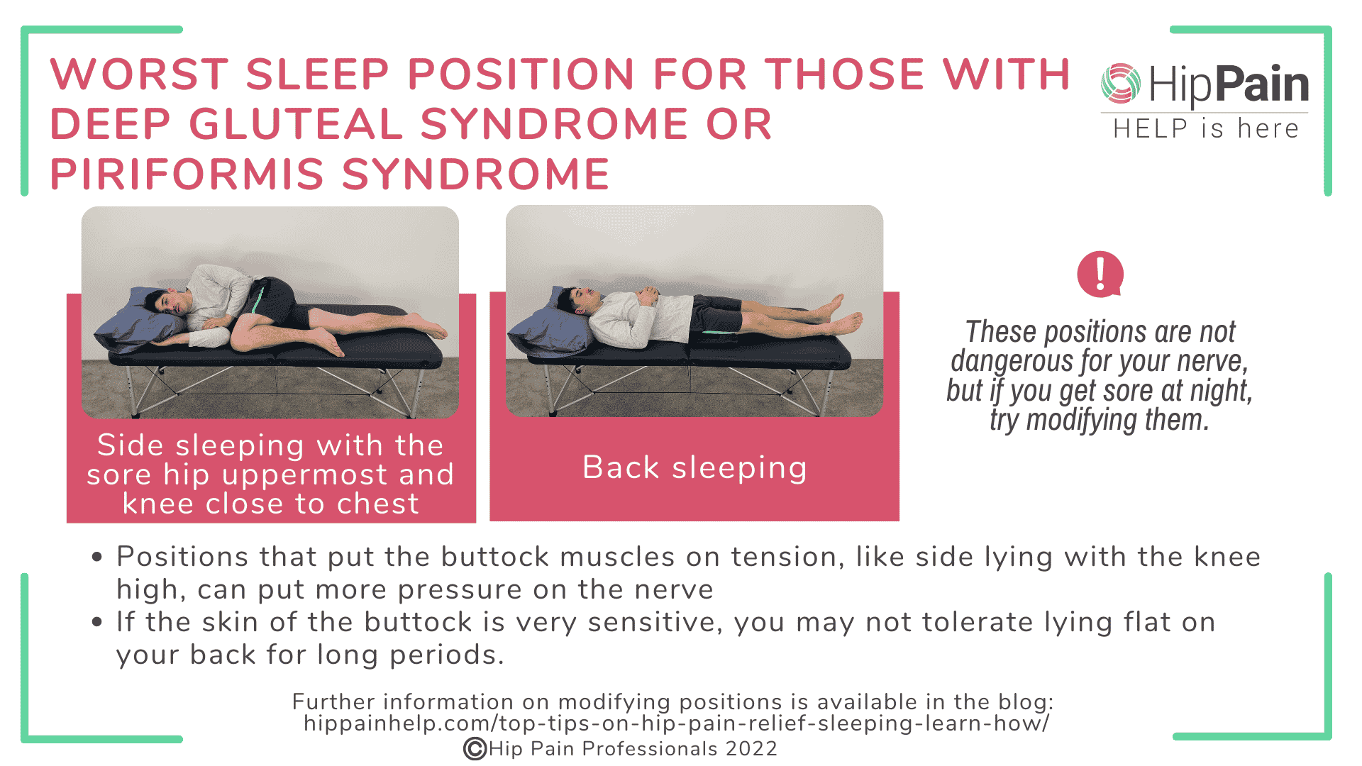 How to Sleep With Piriformis Syndrome