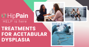 treatment for acetabular dysplasia