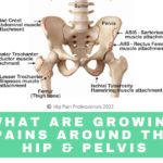 growing pains around the hip and pelvis, apophysitis, avulsion fracture