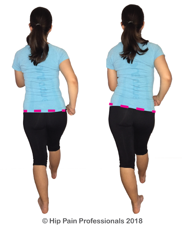 common-walking-patterns-in-those-with-gluteal-tendinopathy