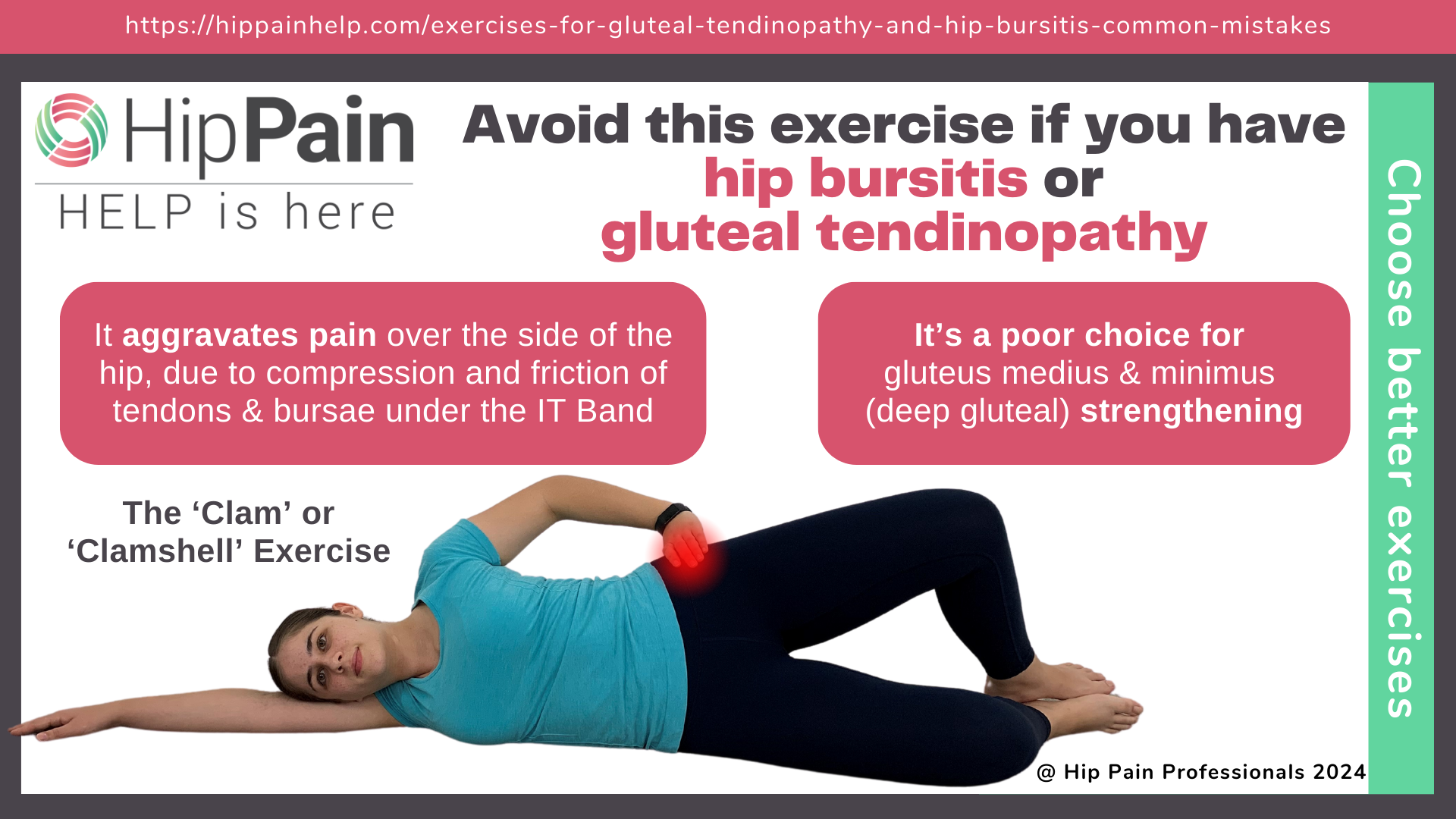 avoid-this-exercise-if-you-have-hip-bursitis-or-gluteal-tendinopathy